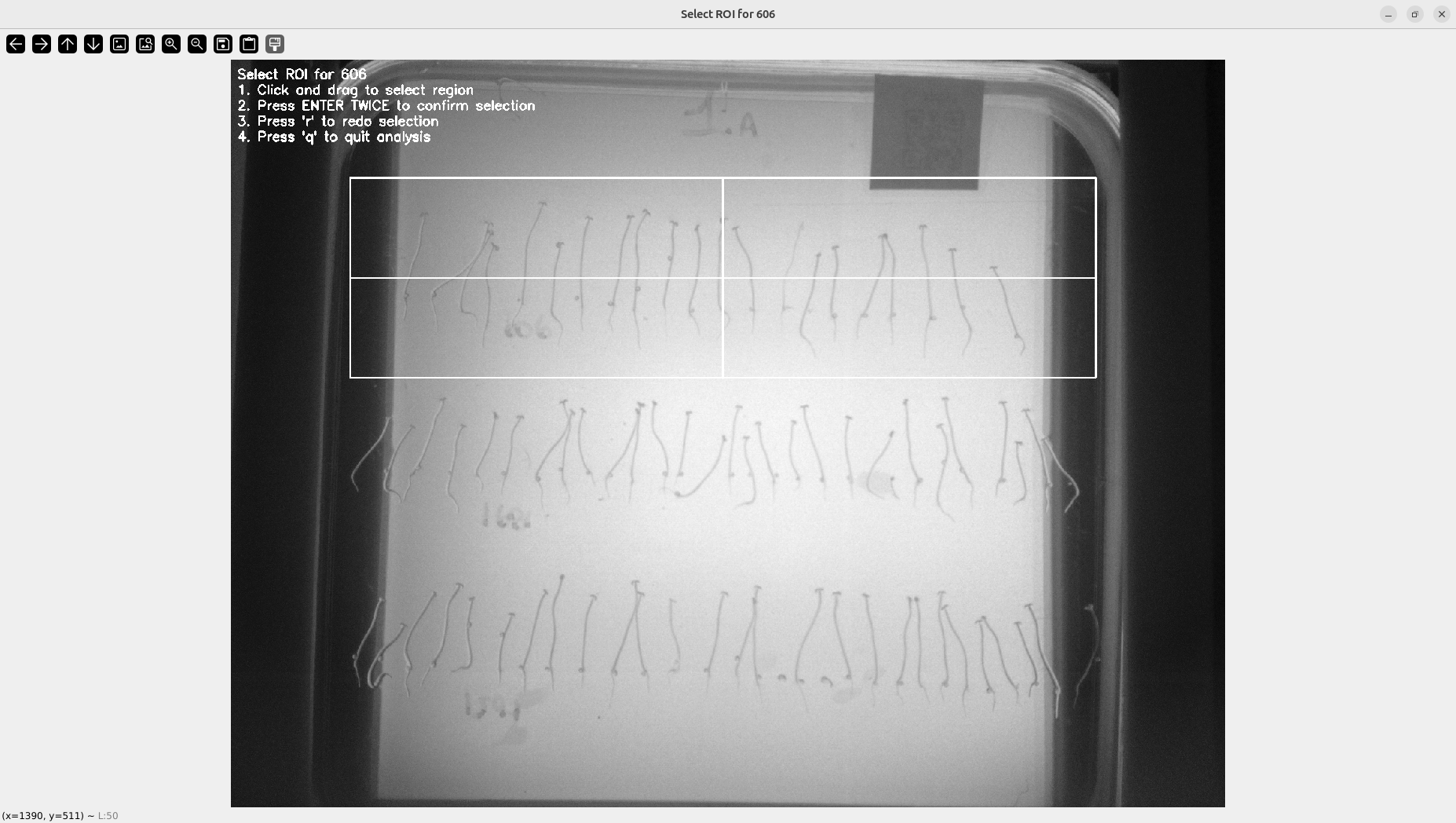 Screening Interface ROI Selection