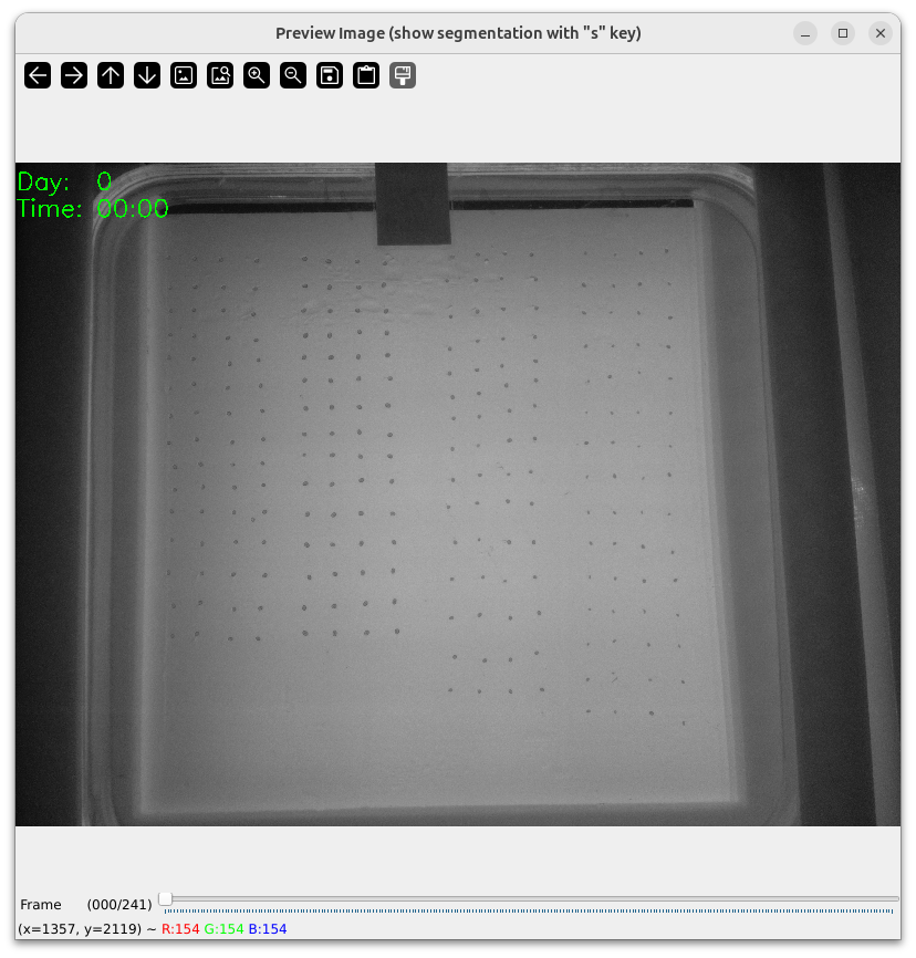 Screening Interface Video Preview